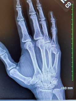 Click image for larger version

Name:	IMG_20250927_085253.jpg
Views:	60
Size:	105.6 KB
ID:	225324