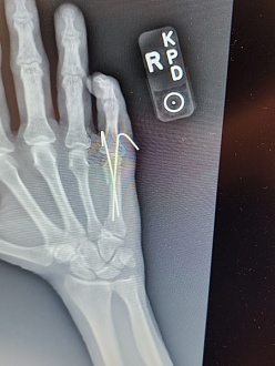 Click image for larger version  Name:	IMG_20251008_115147.jpg Views:	0 Size:	85.3 KB ID:	225335