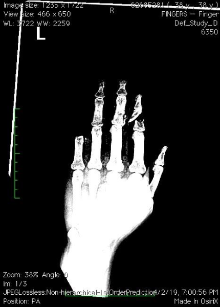 Click image for larger version

Name:	image.png
Views:	64
Size:	124.7 KB
ID:	225341